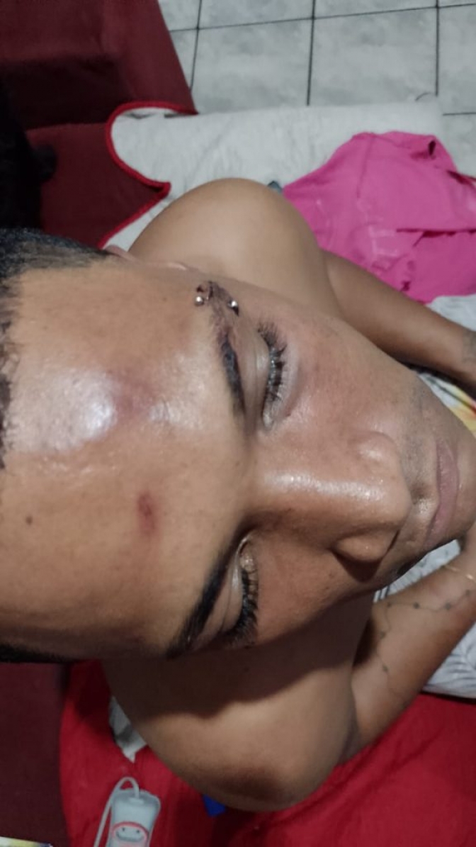 Policiais Militares são acusados de agredir rapaz durante Blitz em Birigui