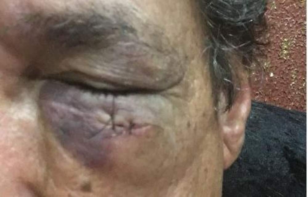 Em Birigui comissão julga improcedente denúncia de quebra de decoro de vereador por cabeçada