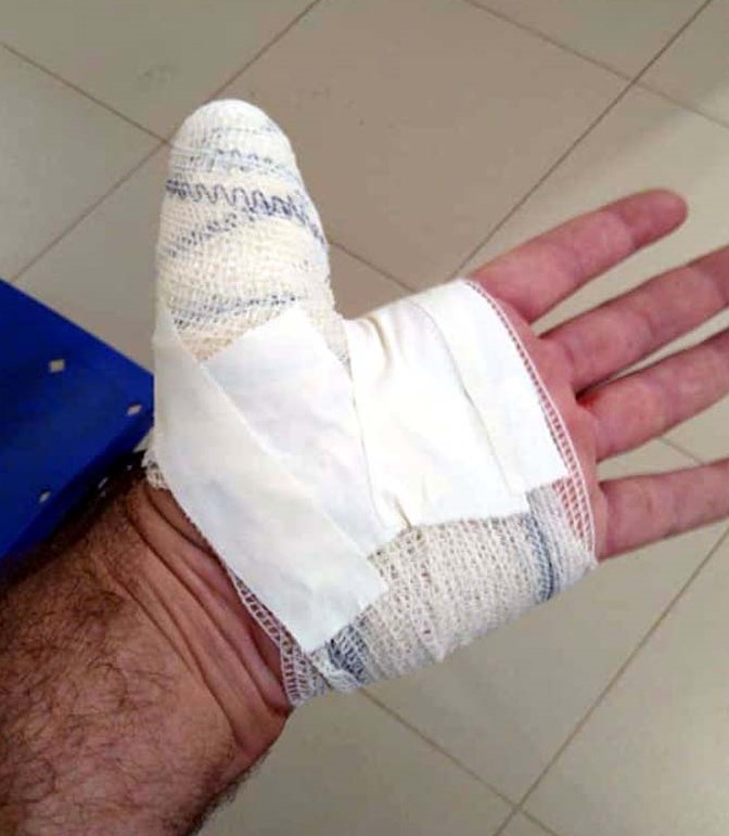 Policial Militar é atropelado durante bloqueio na nova Avenida Guanabara em Andradina