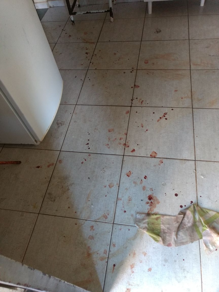 Em Três Lagoas mulher é esfaqueada pelo marido, mas mente para a polícia escondendo que tentou matá-lo antes