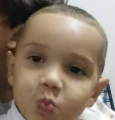 CASTILHO: Garoto de 6 anos não resiste a picada de escorpião e morre