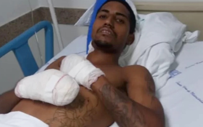 JOVEM VÍTIMA DE ‘MEGA-ASSALTO’ QUE TEVE PÉS DECEPADOS EM EXPLOSÃO DEIXA HOSPITAL DE ARAÇATUBA