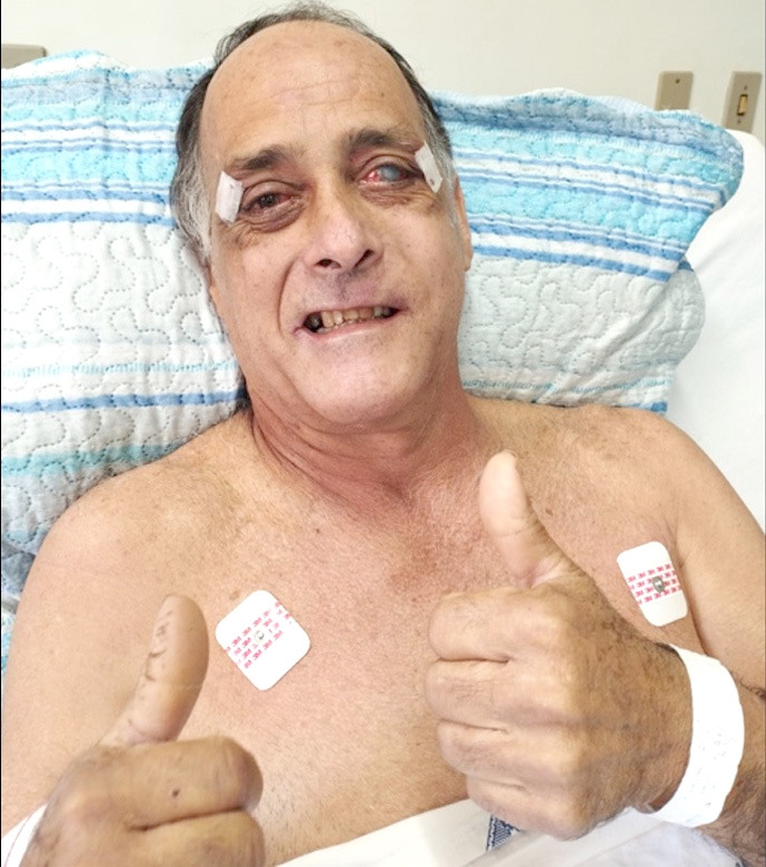 Comerciante de Andradina envolvido em grave acidente de moto já está em casa