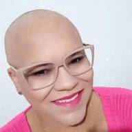 Três-lagoense, posta foto careca e encanta internautas; Conheça Thaynara Pereira Teixeira