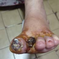Em Andradina filha desesperada pede ajuda para mãe realizar cirurgia